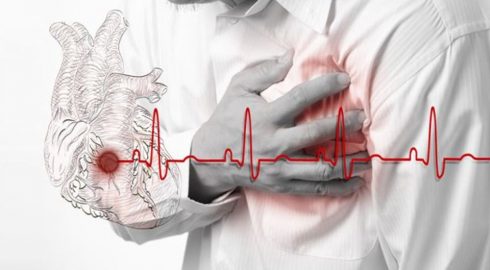 Самые ранние симптомы инфаркта: как распознать опасное состояние за несколько дней до него