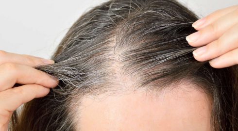 Причины преждевременного поседения, можно ли вырывать седые волосы