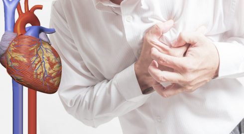 Самый необычный и первый симптом инфаркта, проявляющийся за несколько месяцев до приступа