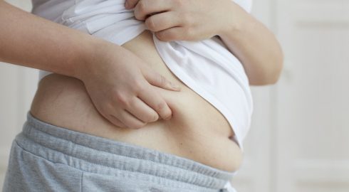 Лишний вес: 5 научных причин, почему не получается похудеть
