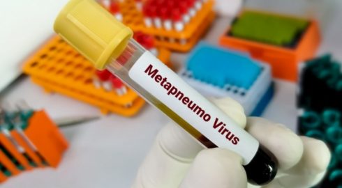 В Роспотребнадзоре метапневмовирус назвали опасной инфекцией: что о нем известно