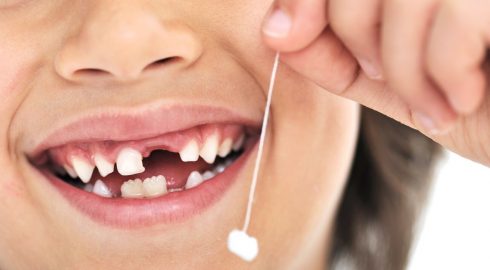 Как потеря всего одного зуба влияет на состояние организма в целом