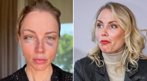 Реакция Кати Гордона на появление синяков у Полины Дибровой